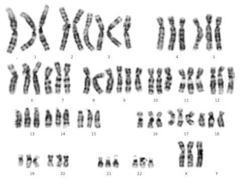 karyotype